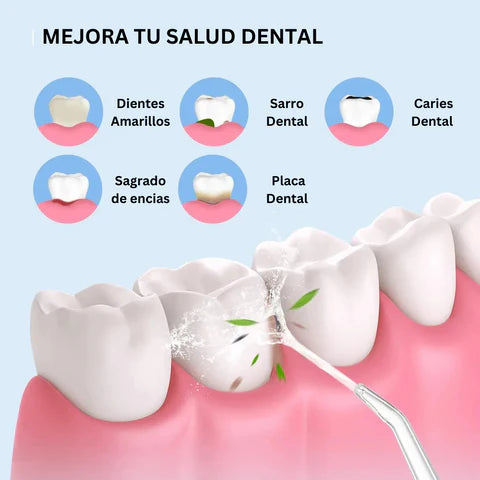 DentaSmile™ - IRRIGADOR BUCAL RECARGABLE