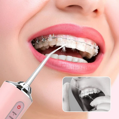 DentaSmile™ - IRRIGADOR BUCAL RECARGABLE