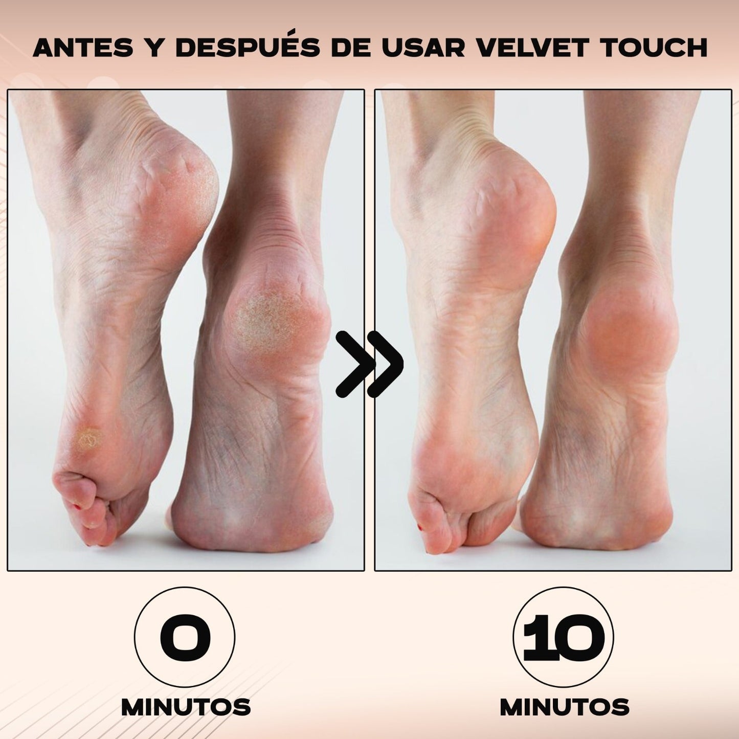 PediBelle™ Lima Anti-Callos Eléctrica Profesional