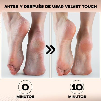 PediBelle™ Lima Anti-Callos Eléctrica Profesional