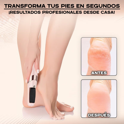 PediBelle™ Lima Anti-Callos Eléctrica Profesional