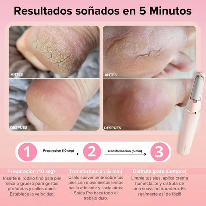 PediBelle™ Lima Anti-Callos Eléctrica Profesional